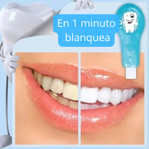 ¡Dientes Blancos en 1 Minuto!