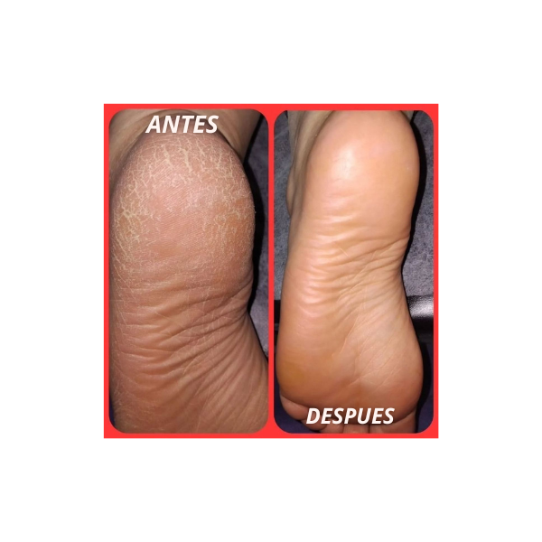 FootSpa